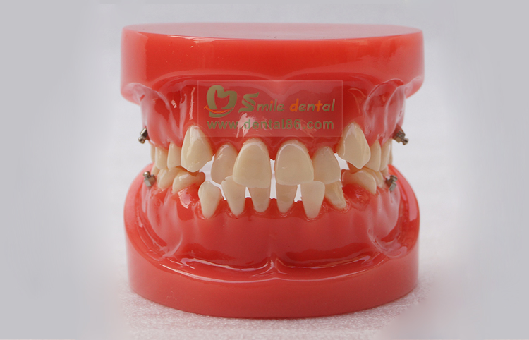 TM-B1 Orthodontic Model